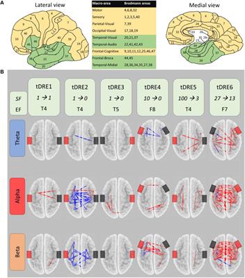 Brain Functional Connectivity Changes After Transcranial Direct Current Stimulation in Epileptic Patients